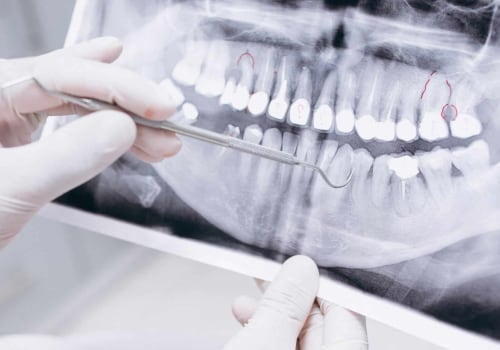 Is Dentistry Part of the Medical Field? A Comprehensive Guide