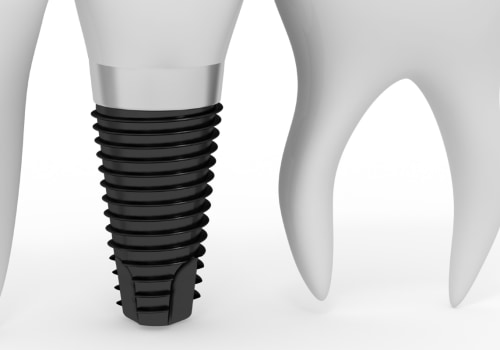 Does Santa Clara Family Health Plan Cover Dental Care?
